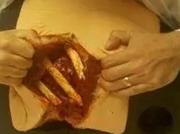 Surgical training model demonstration